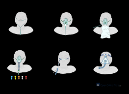 Image result for Moderate Flow Oxygen