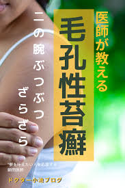 二の腕のブツブツ市販薬 ザラプロ ニノキュア と毛孔性苔癬の情報 二の腕 ぶつぶつ 美容の裏技 二の腕