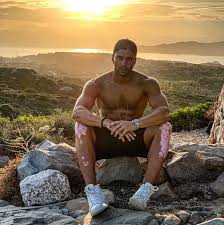 Discover and share the best gifs on tenor. Luca Onestini Parla Della Vitiligine Presente Sul Suo Corpo Le Cose Di Cui Vergognarsi Sono Altre Spettegolando