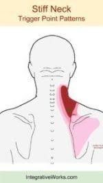 Pin On Stiff Neck