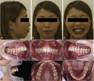 Table of Contents page: The Journal of the American Dental Association