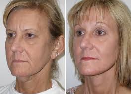 Featured Makeovers 1 Richmond VA