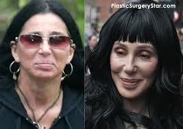 What are today's most popular plastic surgery procedures? Cher Gets Plastic Surgery For A Facelift Cher Plastic Surgery Plastic Surgery Celebrity Plastic Surgery