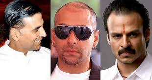 Stars Who Underwent Hair Transplant Orissapost stars who underwent hair transplant
