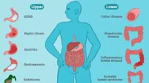 Image result