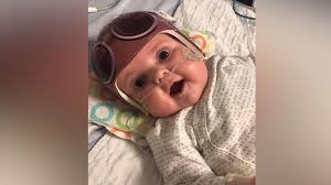 This can be serious if not detected early. Baby Nearly Loses Toes After Strand Of Mother S Hair Cuts Off Circulation