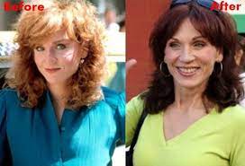 Pin Di Plastic Surgery News
