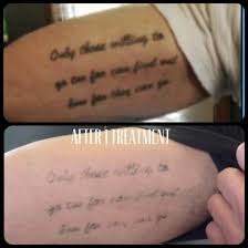 Get instant quality results now! How Much Does Tattoo Removal Cost In Portland Oregon