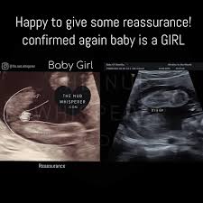 Pin On Gender Prediction