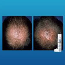 This means it expands blood vessels and potassium channels. Rogaine Foam For Men 5 Minoxidil Treatment For Hair Loss Cvs Pharmacy