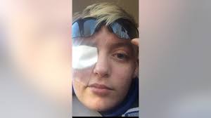 Mississippi woman who was blind in right eye for years regains partial  vision: 'Pretty cool'