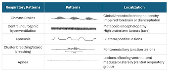 Image result for FOUR Score Coma Exam