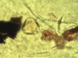 Image result for Psorospermum febrifugum