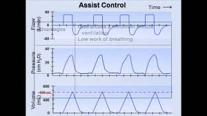 ventilator modes mechanical ventilation lecture 7