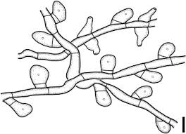 Image result for Uncinula necator