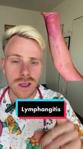Understanding Lymphangitis: Symptoms, Causes, and Treatment
