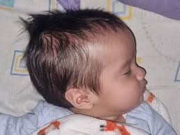 Fundraiser by Monserrat Morales : Ayuda para la cirugía de Bruno