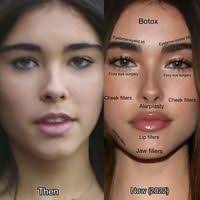 Ron Concepcion (ronconcepcion45)