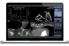 3.0 js host may 26, 2020. Ai Based Cardiac Ct Image Three Dimensional Analysis Fully Automated Medical Device Imaging Technology News