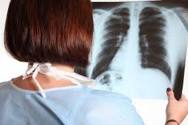 Fibroza Pulmonară