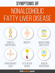 1 In 5 People Unknowingly Have Fatty Liver Disease Here Are The 10 Natural Remedies You Need To Know Liver Detox Fatty Liver Disease Fatty Liver