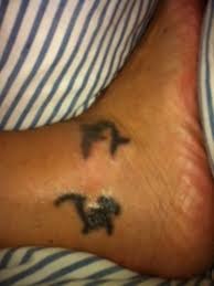 Make sure you don't yourself by rubbing too hard. Rue That Tattoo In One Of Life S Few Do Overs Laser Removal Takes Off