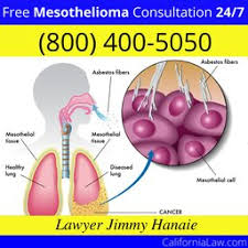 New Almaden Mesothelioma Lawyer Ca Find Best New Almaden Mesothelioma Law