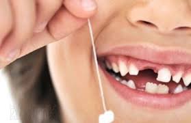 Tout Sur Le Changement De Dents De Lait Effetsante Com