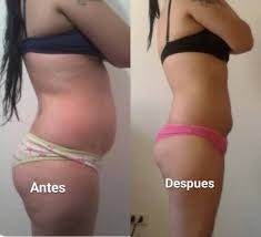 Resultado de imagen para masaje reductivo