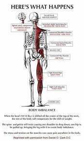 Pin On Health
