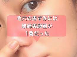 毛穴の黒ずみには美顔器が1番だった いちご鼻 毛穴 美顔