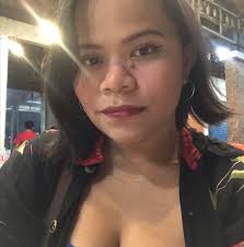 MPOX, DUMARAMI ANG KASO SA BANSA! 😱