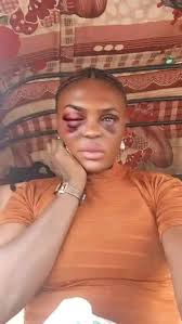 Houdini may only have one eye and battered ears, but he is still so  handsome. Wouldn't you agree?