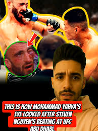 Ufc Yahya Eye