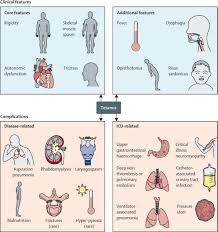 Image result for Tetanus