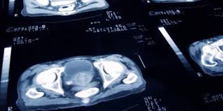If you gave birth in clinique du pont de chaume and liked the treatment you received from the staff working in this hospital, you can recommend it to other future mothers. Medecine D Urgences A La Clinique Pont De Chaume A Montauban