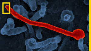 Nov 05, 2019 · diagnosing ebola virus disease (evd) shortly after infection can be difficult. What Is Ebola Virus Disease