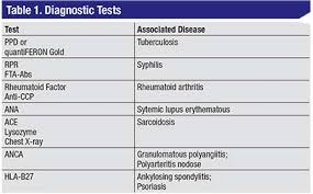 Image result for Scleritis