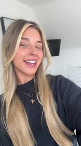 Best thubg ive done #invisalign #fyp