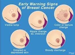 Or they might cause a burning sensation at the spot where you have the drug injection. Five Things Friday Breast Cancer Symptoms Albie Aware Breast Cancer Foundation