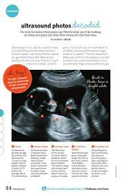 This ultrasound can only be scheduled if you have already seen your ob/gyn. Free Pregnancy Ultrasound Phoenix Guide At En Mdg Sdg3d Undp Org