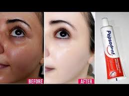 5 Manfaat Menakjubkan Pasta Gigi Untuk Kecantikan Sehat Tube Youtube Vaseline Beauty Tips Pemutih Gigi Alami Pemutih Kulit