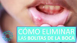 Bolita En La Boca Todas Las Causas Y Soluciones