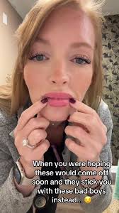 Unexpected Orthodontics Journey with Braces