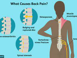 Other muscles in the back are associated with the movement of the neck and shoulders. Back Pain Causes Treatment And When To See A Doctor