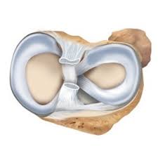Außenmeniskus) sind ringförmige, knorpelige puffer zwischen oberschenkel und unterschenkel (bild. Meniskus Knieschmerz Osteoarthritis Behandlungen Und Implantate Active Implants Eu