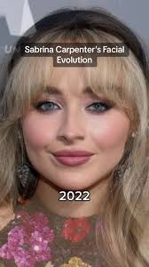Sabrina Carpenter Before and After: Plastic Surgery Transformation