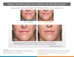 Before & After Cosmetic Treatments West Orange NJ