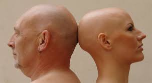 Clinicaltrials.gov lists trials that are related to alopecia totalis. Alopecia Totalis My Hair Doctor Prescription Haircare