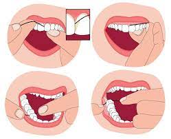 Jan 08, 2020 · instead of using waxed floss, other options that work well for flossing if you have braces include using a waterpik, a type of water flosser, or a floss threader, a small tool that helps you. Common Flossing Mistakes Magnolia Dental